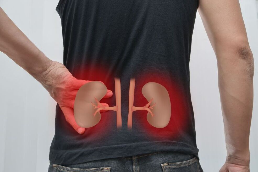 воспаление на бубрезите како причина за болки во грбот